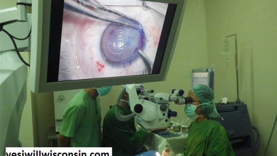 Transplantasi dan Donasi Kornea Mata