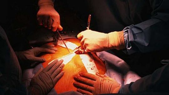 Donasi Organ di AS dan Eropa